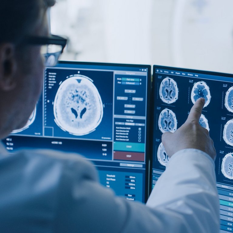 Zwei Ärzt*innen analysieren Gehirnscans auf mehreren Monitoren. Einer zeigt auf auffällige Bereiche der MRT-Bilder.