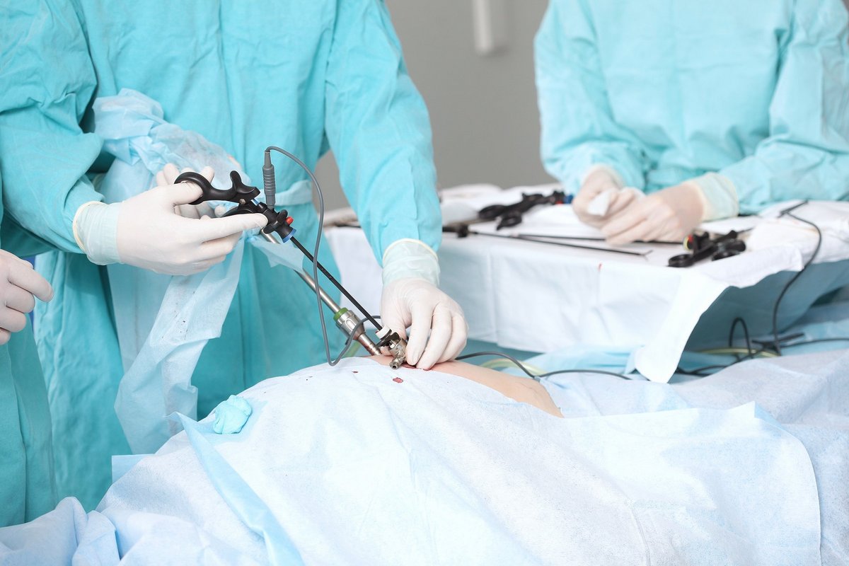 Modern abdominal surgery. Laparoscopy in surgery. Surgical intervention through small holes. Surgical team. Laparoscopic instruments.Hands in protective gloves. Das Bild zeigt eine minimalinvasive Operation, bei der Ärzt:innen laparoskopische Instrumente verwenden.