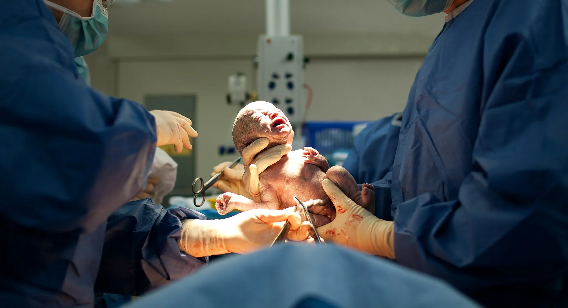 Das Bild zeigt ein neugeborenes Baby bei einem Kaiserschnitt. Die OP-Kleidung des Personals, die Umgebung und die Position des Babys deuten auf eine gerade erfolgte Entbindung hin.